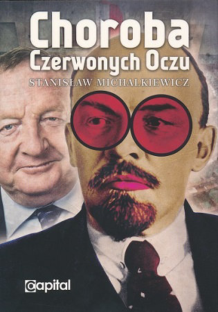 Choroba czerwonych oczu - Stanisław Michalkiewicz	